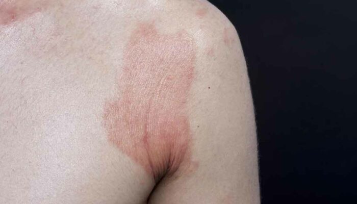 How to identify a skin rash