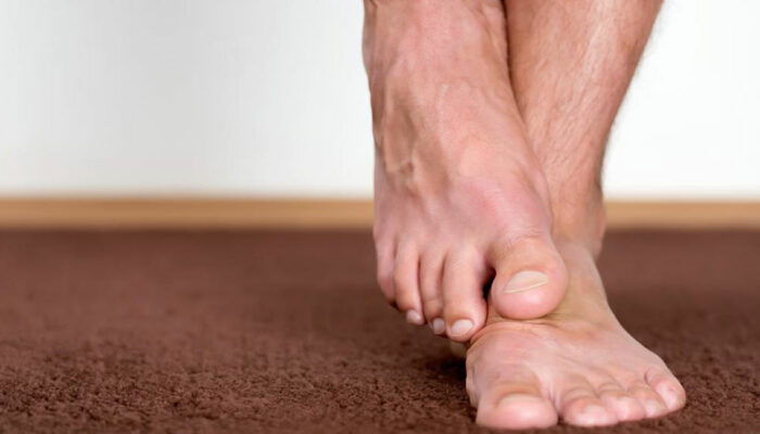 How Diabetes Causes Foot Problems