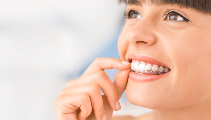 How and why are crowded teeth fixed