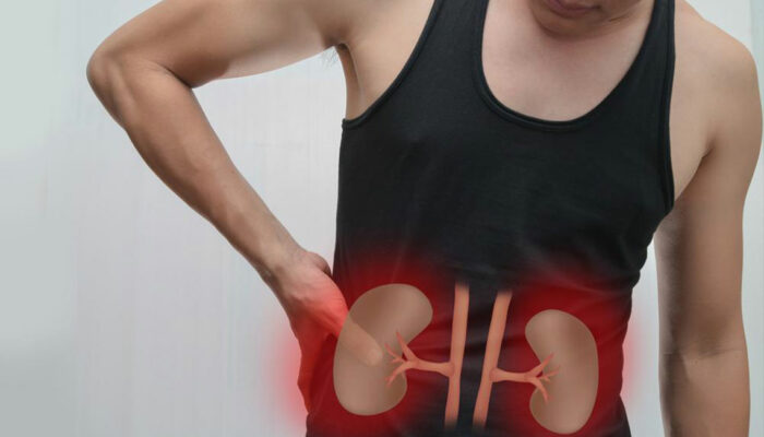 Kidney Failure &#8211; Causes and Symptoms