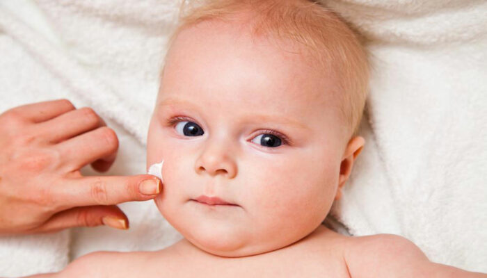 Know More About The Symptoms Causes And Treatment Options For Eczema In Infants