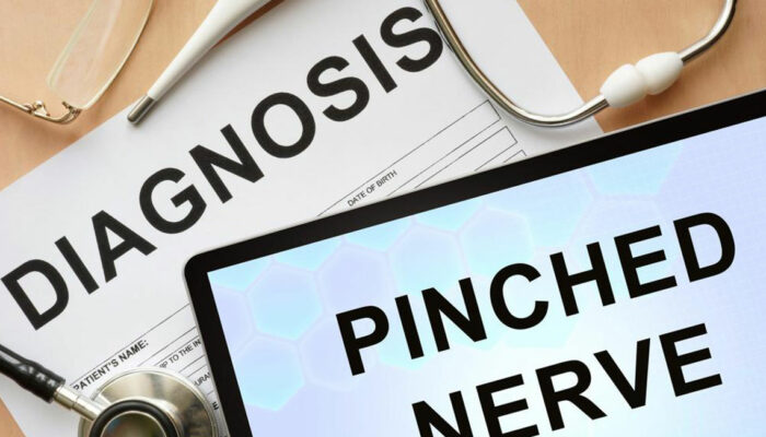 Know about the Pinched Nerve Treatment, Causes, and Symptoms