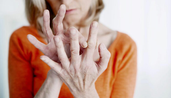 Know the Common Symptoms Of Rheumatoid Arthritis