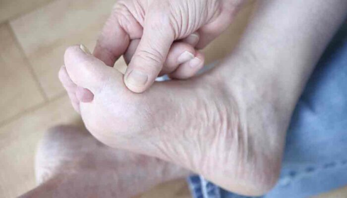 Managing Gout Foot Pain Effectively