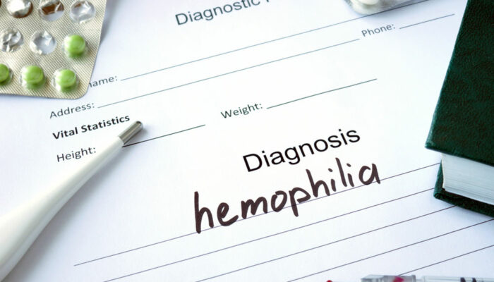 Must Know Facts About Hemophilia