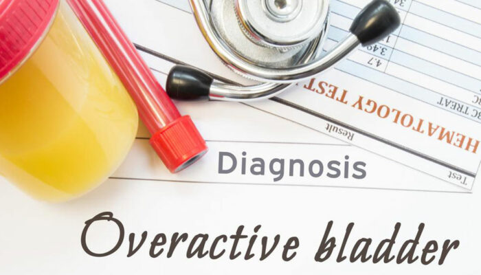 Natural Ways to Deal with an Overactive Bladder