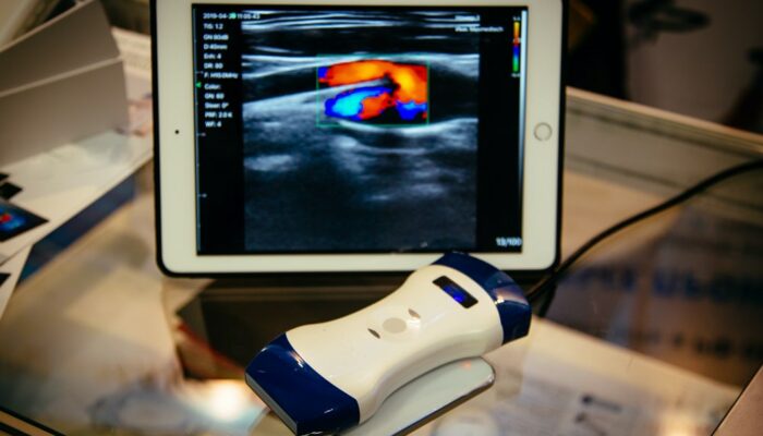 Portable ultrasound machines &#8211; Types and top choices