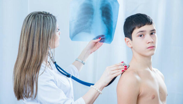 Pneumococcal Pneumonia &#8211; Symptoms, Treatment, and More