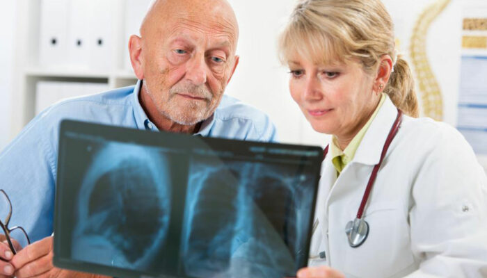 Pneumonia &#8211; Prognosis and Treatment Options