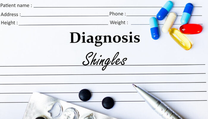 Shingles &#8211; Symptoms, Risk Factors, and Treatments