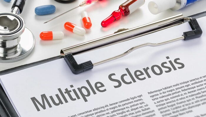 Stages, diagnosis, and prevention of multiple sclerosis