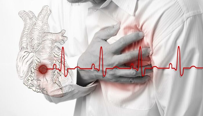 Symptoms And Treatment For Atrial Fibrillation