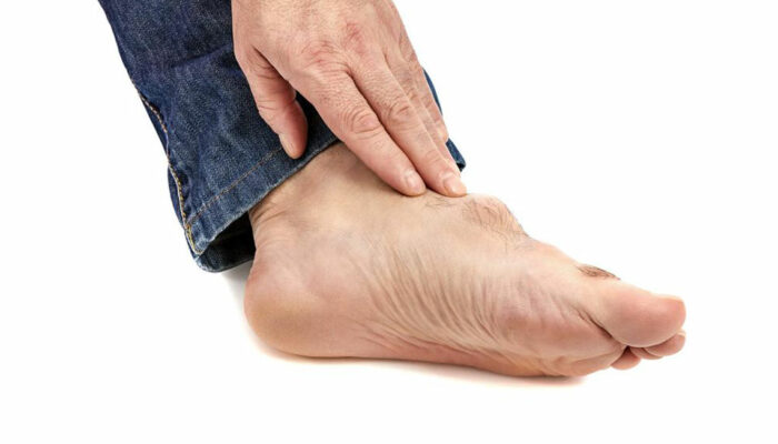 Symptoms, Causes, and Treatment of Gout