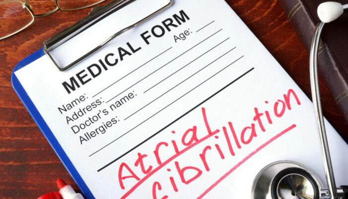 Symptoms, Diagnosis and Treatment of Atrial Fibrillation