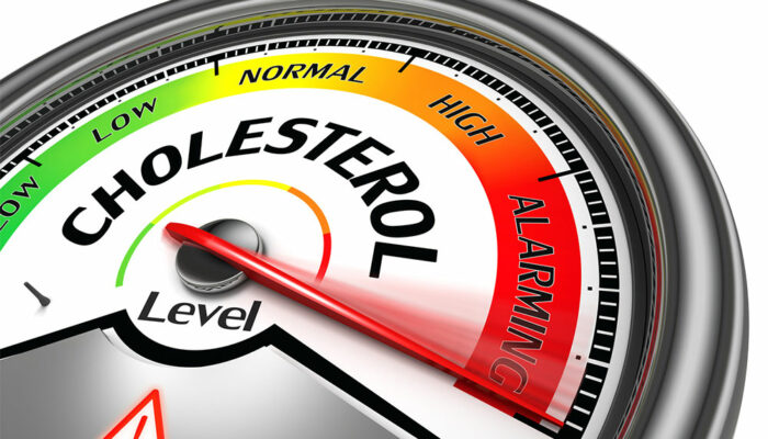 The truth about cholesterol