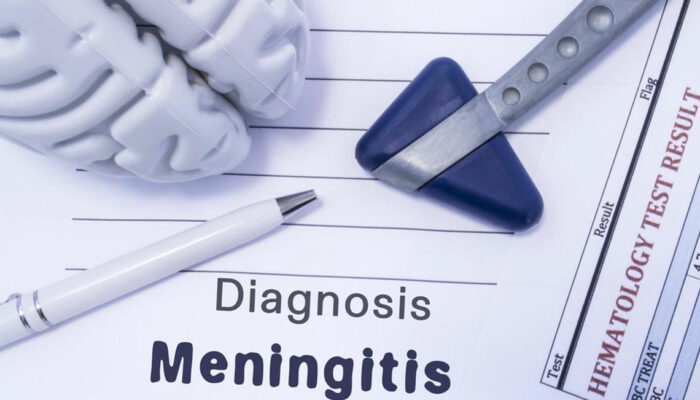 The What and Why of Strep Meningitis