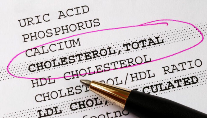 Things You Need To Know About Cholesterol