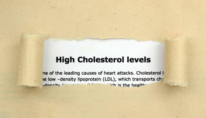 Things You Need to Know about Cholesterol Levels