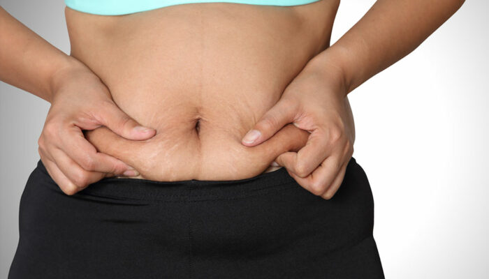 Tips to Lose Stubborn Belly Fat