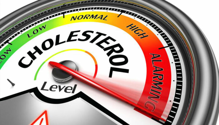 Tips to Manage Your Cholesterol Levels