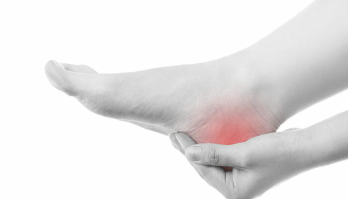 Top 5 Gout Treatment That You Should Start Following Immediately