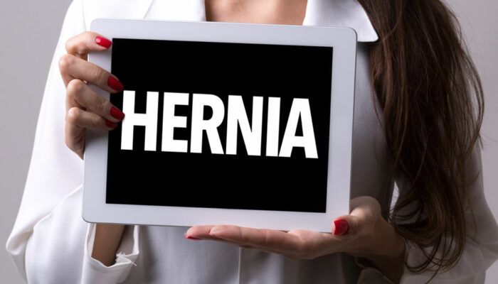 Treatment Options for a Hiatal Hernia