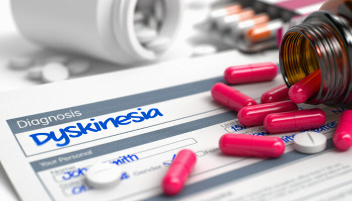 Treatment options for dyskinesia