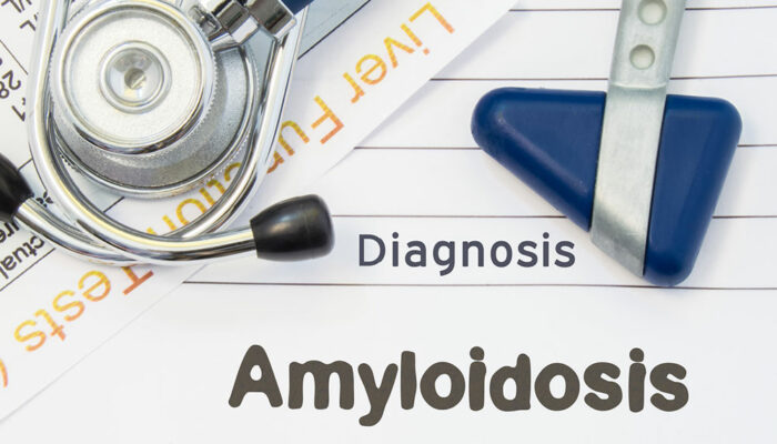 Two Types of Hereditary Amyloidosis You Need to be Aware of