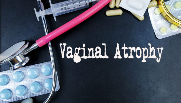 Vaginal Atrophy Treatment &#8211; An Overview