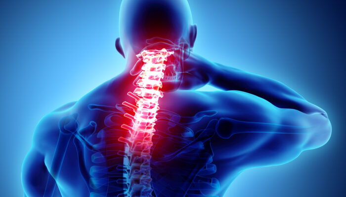 Various Causes Of Pain In The Neck