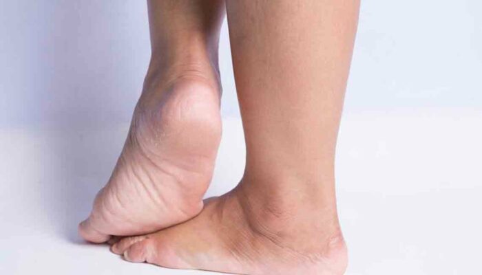 Walk In Stride By Treating Heel Pain