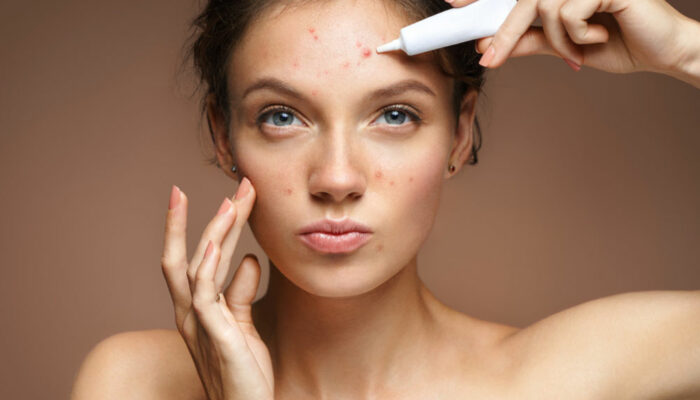 Ways To Manage Sensitive Skin Problems