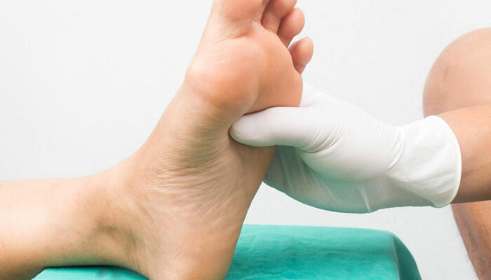 Ways to Deal with Diabetic Neuropathy