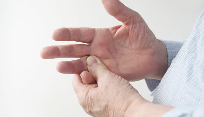 Ways to manage and avoid rheumatoid arthritis