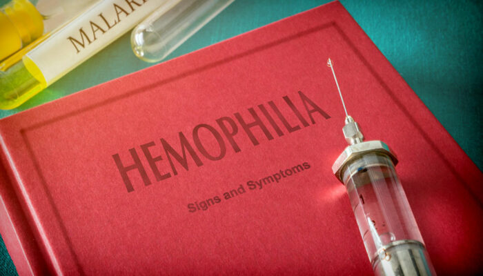 What are the symptoms of hemophilia