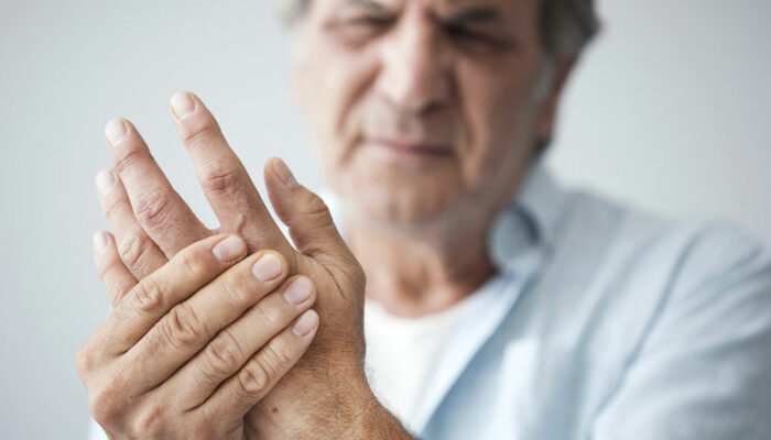 What you did not know about arthritis