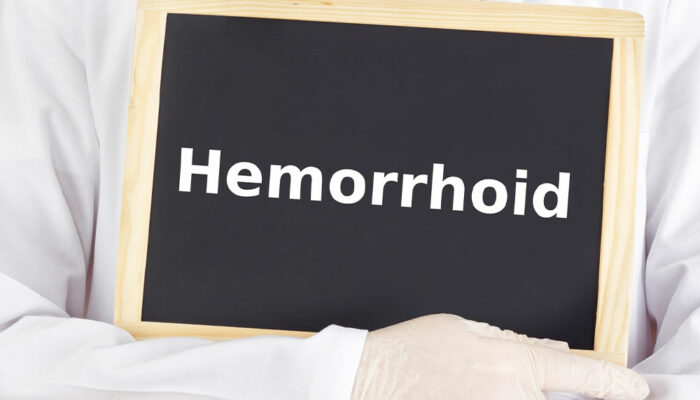 Causes and Treatments of Hemorrhoids