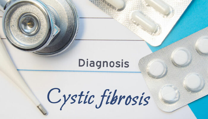 Diagnosis &#038; Treatment of Cystic Fibrosis