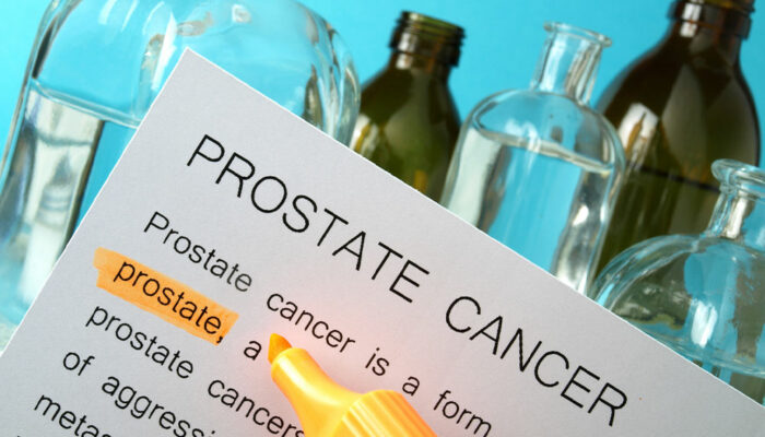 Prostate Cancer Symptoms