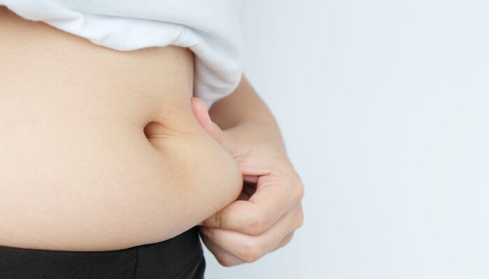 Six FAQs on CoolSculpting Fat Freezing