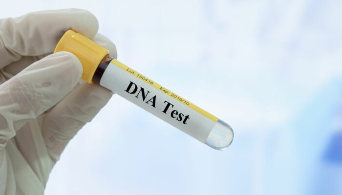 Things to Know Before Taking a DNA Test