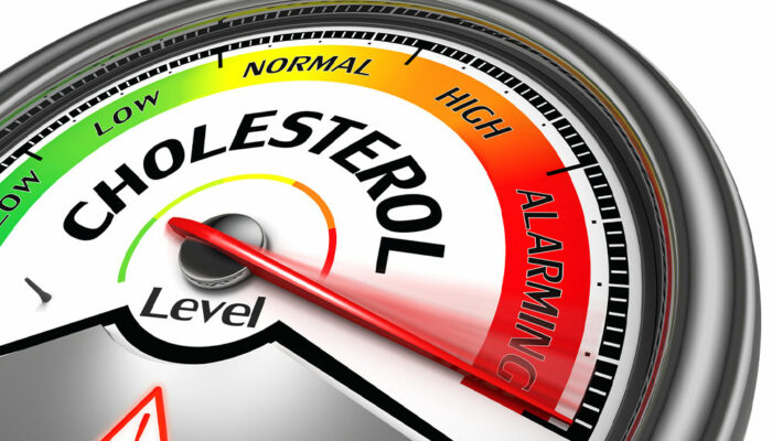 What You Need to Understand About Cholesterol