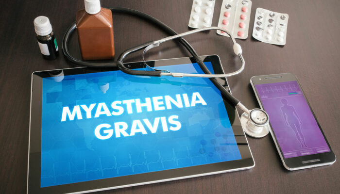 Myasthenia Gravis &#8211; Causes, Symptoms, and Prevention Methods