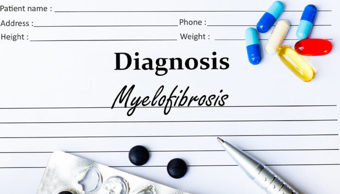 Myelofibrosis &#8211; Symptoms, causes, and management options