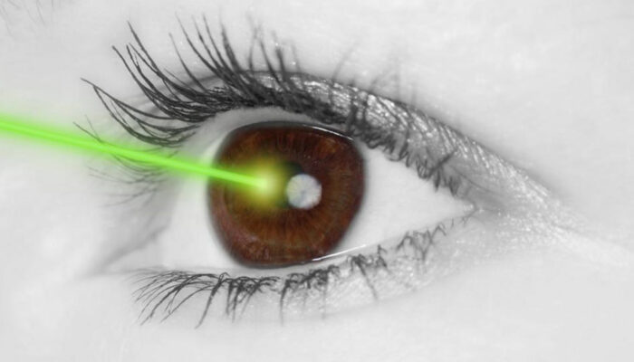 Lasik Eye Surgery Cost And Procedure