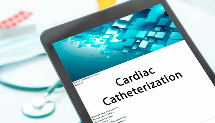 Everything to Know About Heart Catheterization Procedure