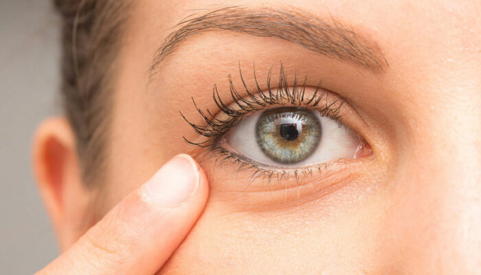 Tips to Find a Surgeon for Eye Bag Removal