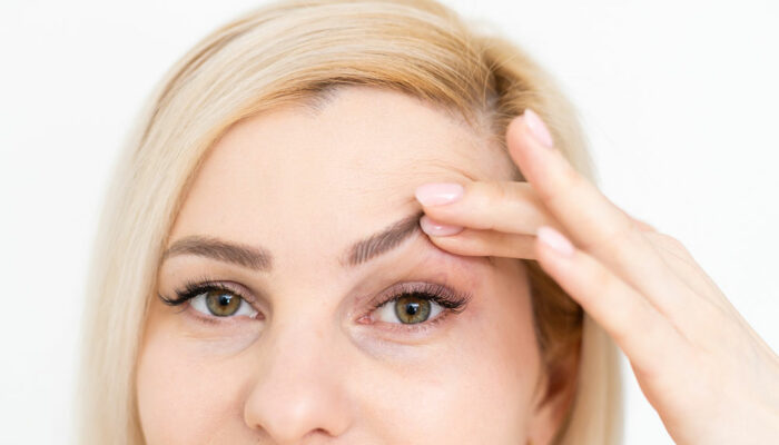 Management Options to Fix Droopy Eyelids