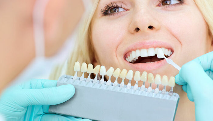 4 Common Types of Dental Implants and Their Costs