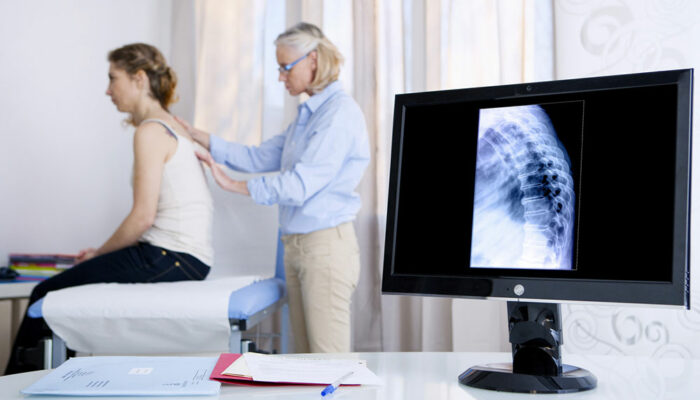 10 Tips for Choosing an Osteoporosis Specialist